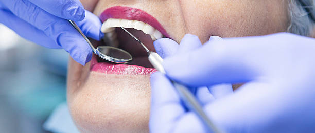 Best Urgent Care for Lost Fillings or Crowns in Toquerville, UT